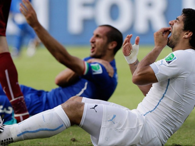 Να τιμωρηθεί ή όχι ο Luis Suarez για το δάγκωμα αντιπάλου του στο Μουντιάλ;
