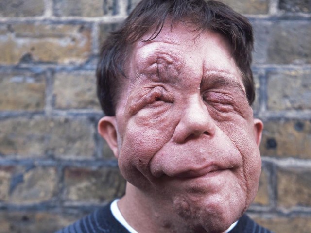 Άνταμ Πίρσον, η ομορφιά είναι κάτω από το δέρμα.